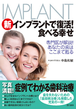 専門医中島先生の書籍で、信頼できるインプラントドクターとして、総院長が紹介されています。