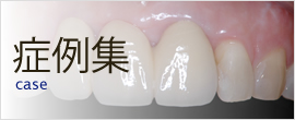 症例集